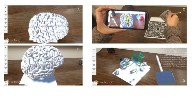 Mettre la réalité augmentée au service de la neurochirurgie Featured Image