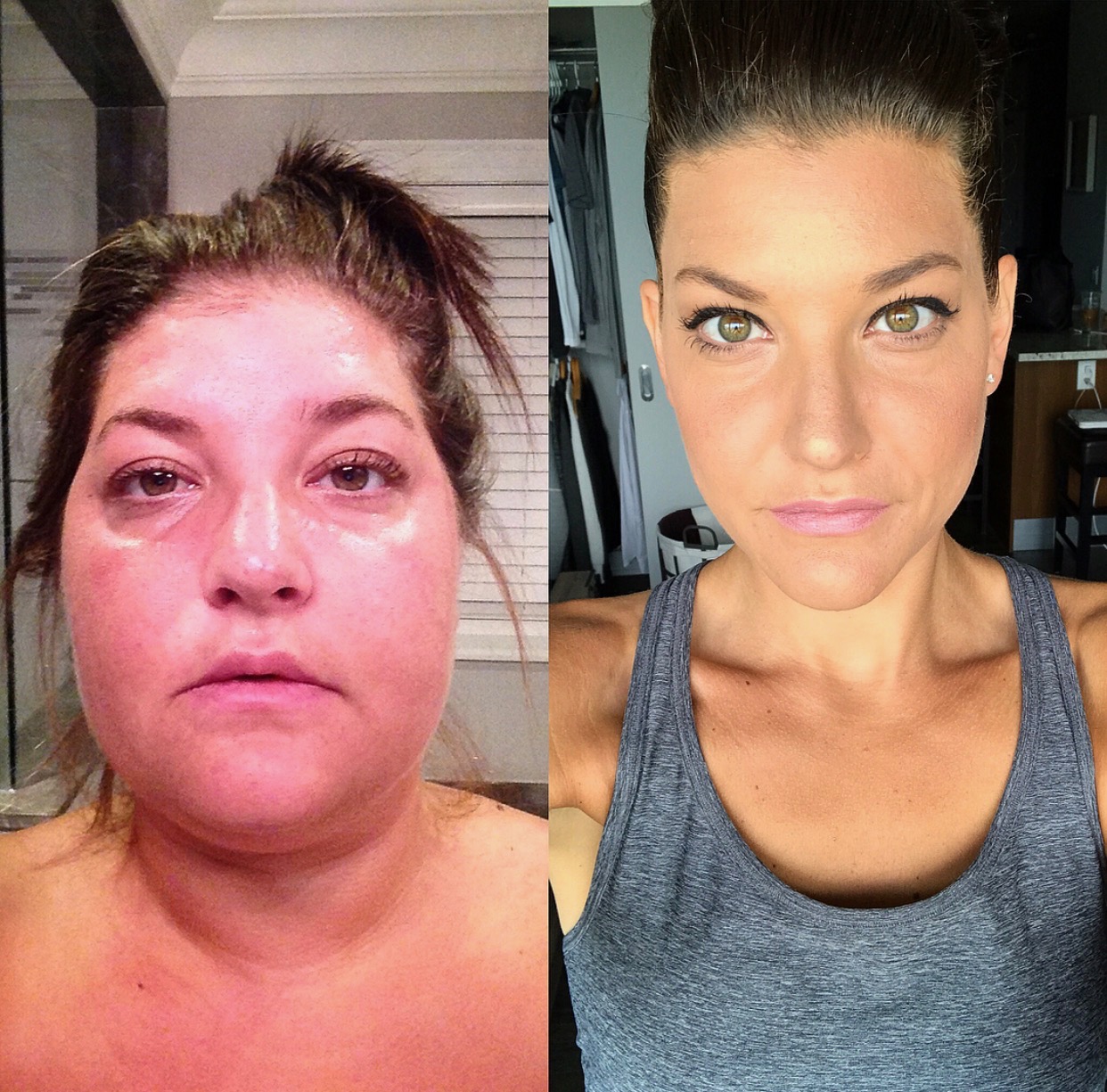 Living and Fighting with Two Diseases Danielle